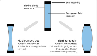Illustration for article titled How Oil-Filled Lenses are Bringing Sight to Those in Need